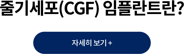 ٱ⼼(CGF) öƮ?